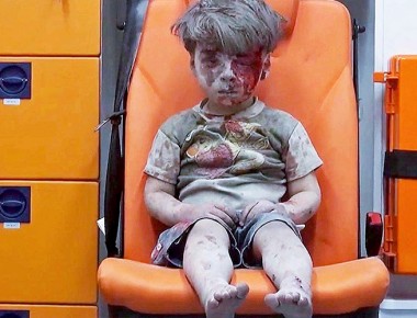 Imagen de niño sirio herido conmueve al mundo