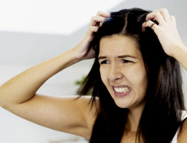 ¿Problemas de caspa? Dile adiós con estos tips