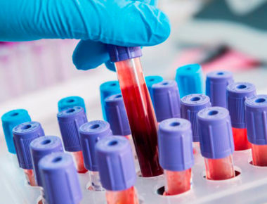 Sabías que sangre tipo O es la más resistente ante el Covid-19