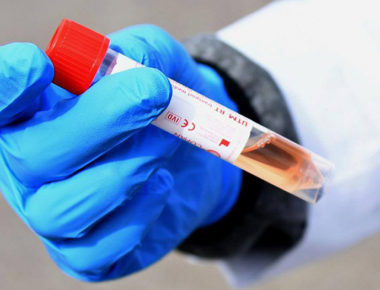 Nuevo estudio sugiere que el coronavirus no es tan mortal como se pensaba