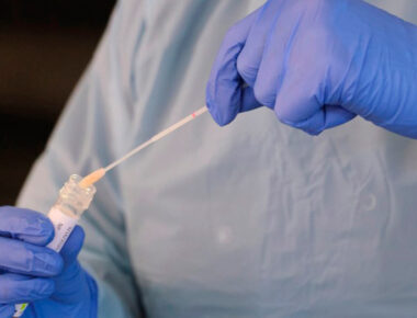 Alemania dona 100 mil pruebas de coronavirus a Perú